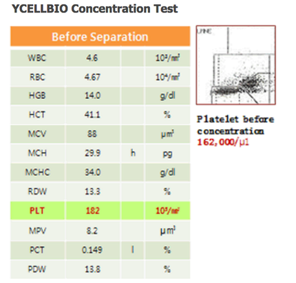 prp-better-concentrations_med