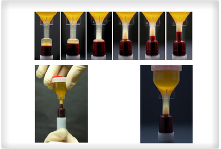 prp-or-platelet-rich-plasma_med-2